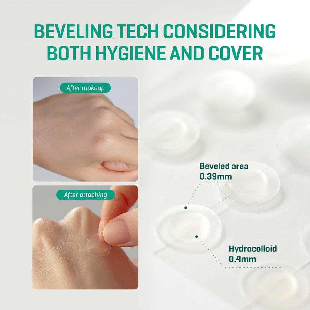 SOMEBYMI – 30 Days Miracle Clear Spot Patch - 18 pcs