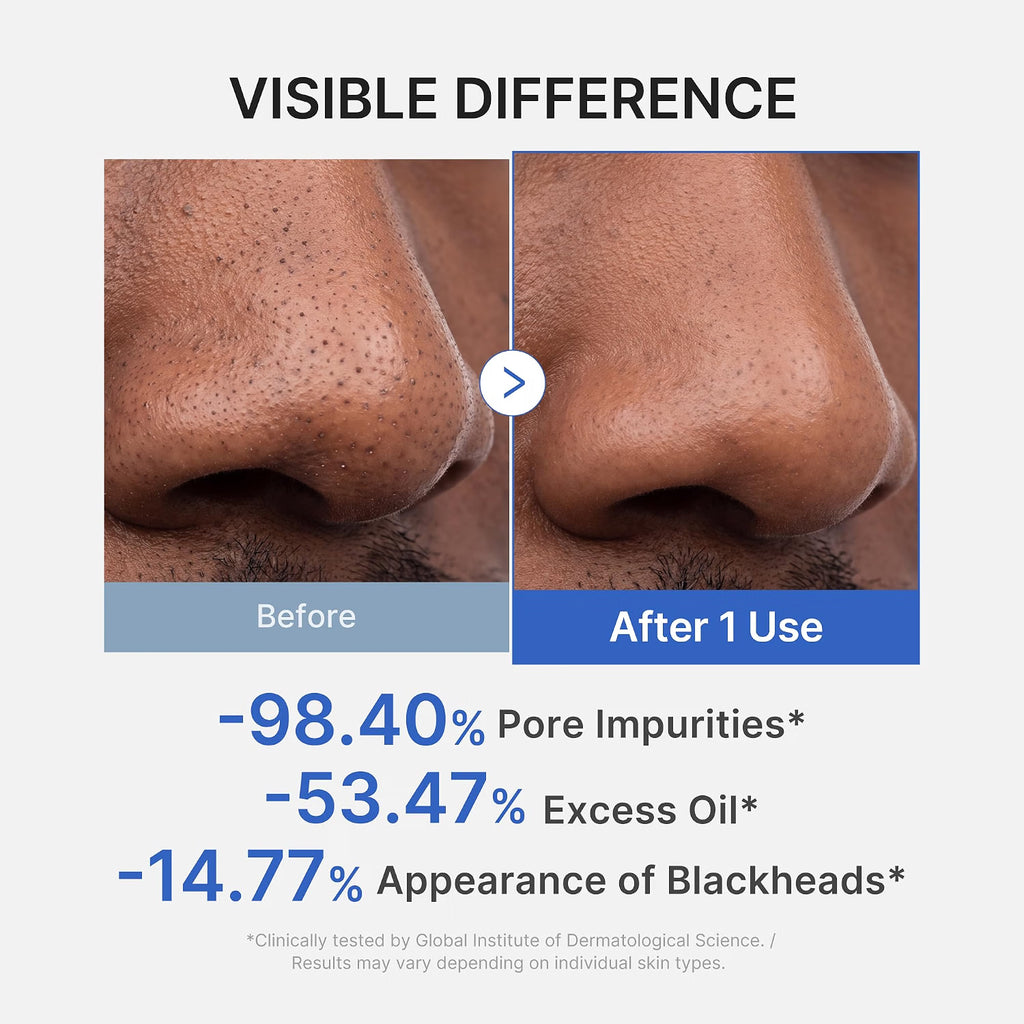 Medicube [EUP] Zero Pore Blackhead Mud Mask - 100g