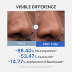 Medicube [EUP] Zero Pore Blackhead Mud Mask - 100g