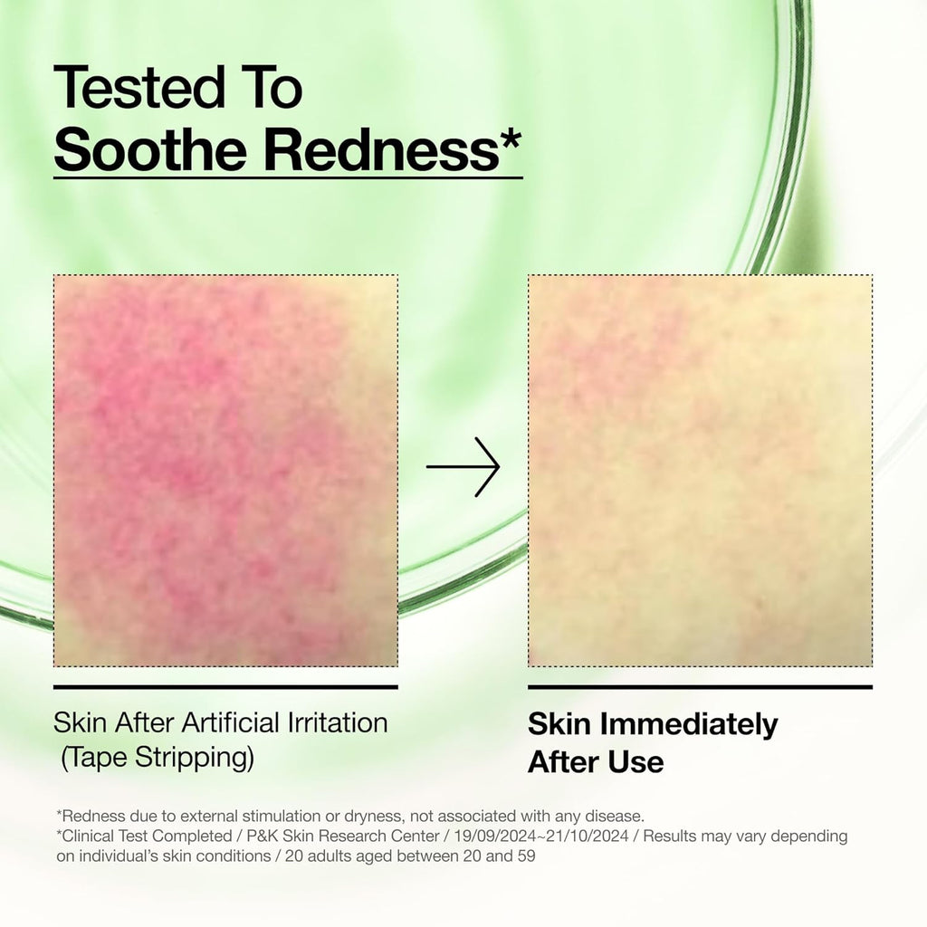 ANUA Azelaic Acid 10 + Hyaluron - 30ml