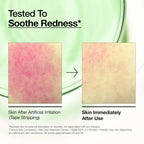 ANUA Azelaic Acid 10 + Hyaluron - 30ml