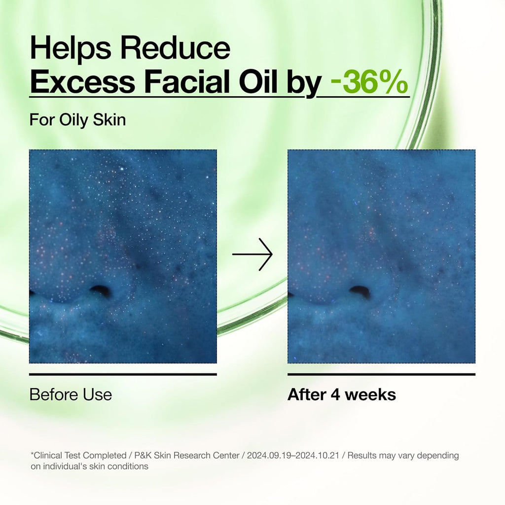 ANUA Azelaic Acid 10 + Hyaluron - 30ml