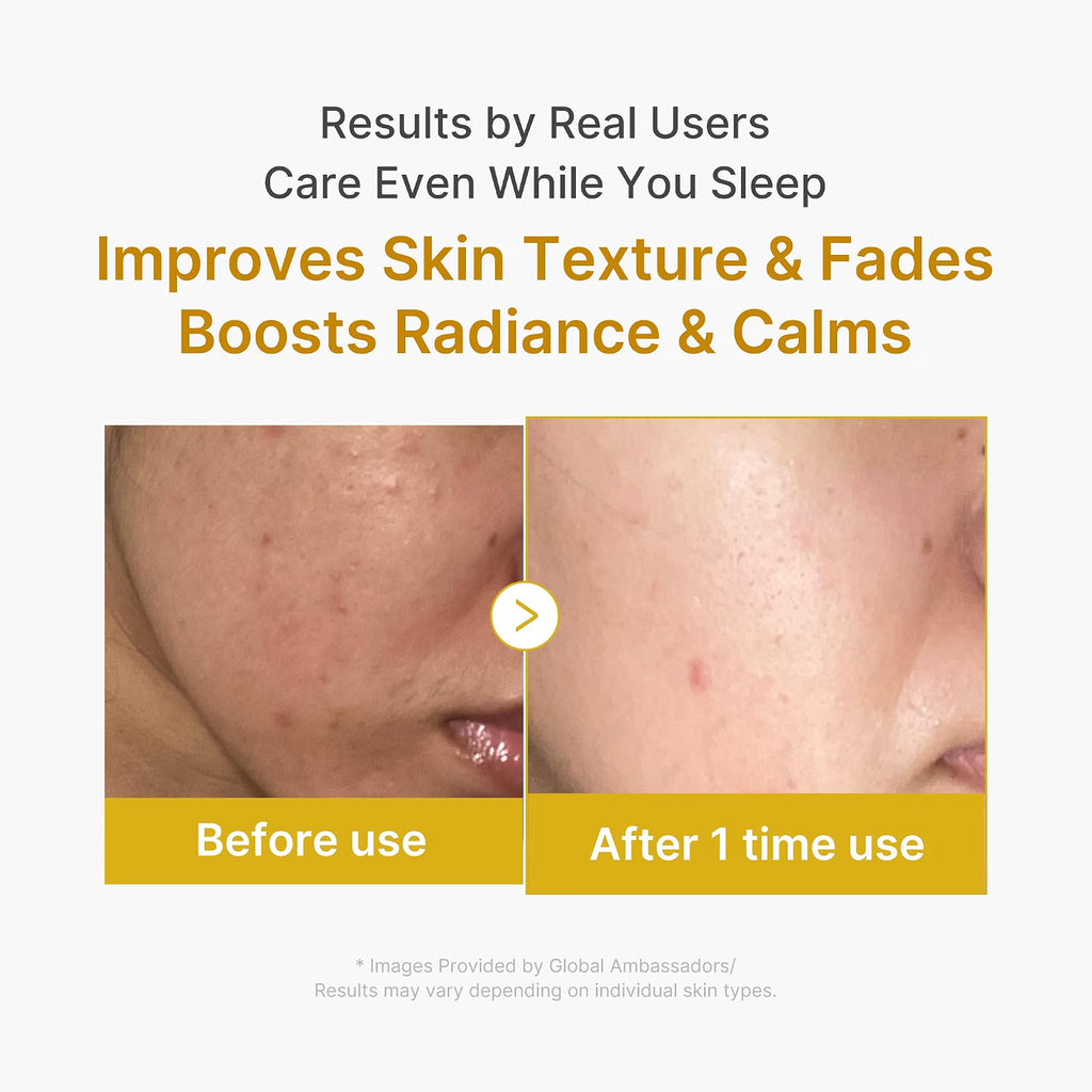 Medicube Kojic Acid Turmeric Night Wrapping Mask 2.0 — 75ml