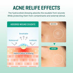 SOMEBYMI – 30 Days Miracle Clear Spot Patch - 18 pcs