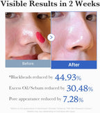 MEDICUBE ZERO PORE PAD 2.0 - 70pcs - Yuna